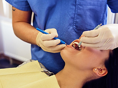 Why Women Hair Transplant